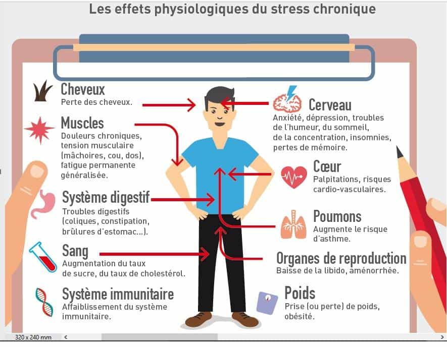 Stress au travail : causes, symptômes, solutions